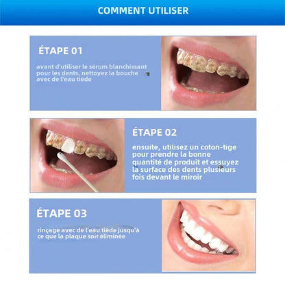 Gel de Blanchissement des dents